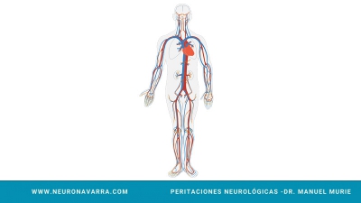 Neuronavarra Peritaciones Manuel Murie DISECCIÓN CAROTIDEA