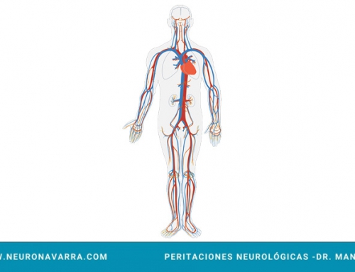 DISECCIÓN CAROTIDEA