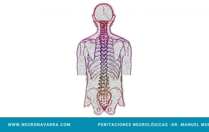 Neuronavarra Peritaciones Manuel Murie DOLOR LUMBAR; RADICULOPATÍA CRÓNICA