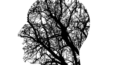 Neuronavarra.com - Peritacion caso de ictus