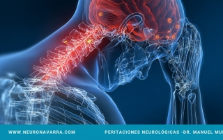 Neuronavarra Peritaciones Manuel Murie Fibromialgia