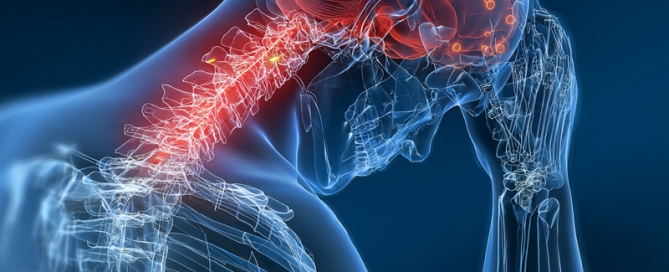 Neuronavarra Peritaciones Manuel Murie Fibromialgia