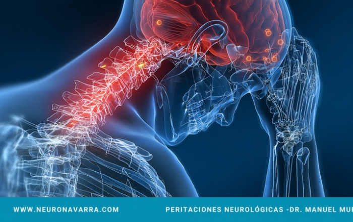 Neuronavarra Peritaciones Manuel Murie Fibromialgia