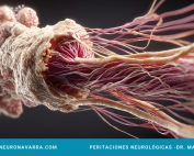 Neuronavarra Peritaciones Manuel Murie - Neuralgia del trigémino